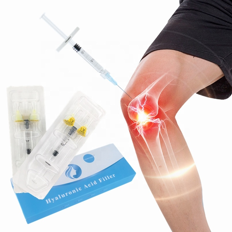 10ml Hyaluronic Acid Dermal Filler Knee Pain Knee Joint Injection Ostearthritis Filler
