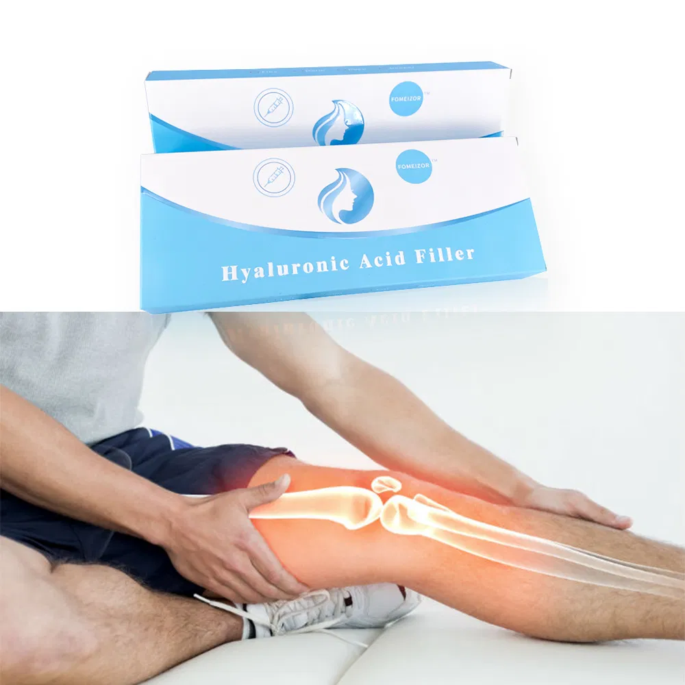 10ml Hyaluronic Acid Dermal Filler Knee Pain Knee Joint Injection Ostearthritis Filler