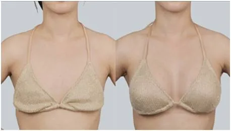 10ml Pure Hyaluronic Acid Brest Injection for Penies Enlargement Cream Buttocks and Breast Enlargement Injection