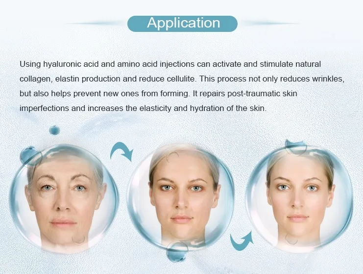 12mg 20mg 36mg 60mg 100mg Non Crosslinked Hyaluronic Acid Dermal Filler for Whole Face Injection
