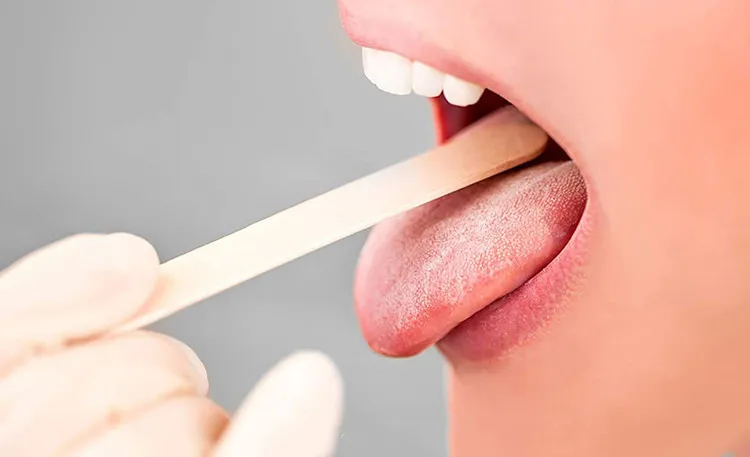 200mm Medical Surgical Dental Disposable Wooden Spatula