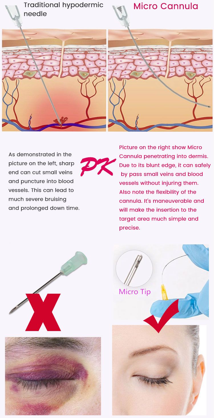 2021 ODM Provide Medical Supply Disposable Steril Micro Cannula Needle