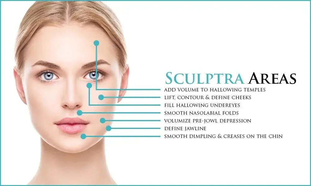 2021sculptra Injection/Sculptra Dermal Filler Sculptra Plla/Sculptra Aesthetic Sculptra Relleno Dermico Sculptra Buttock