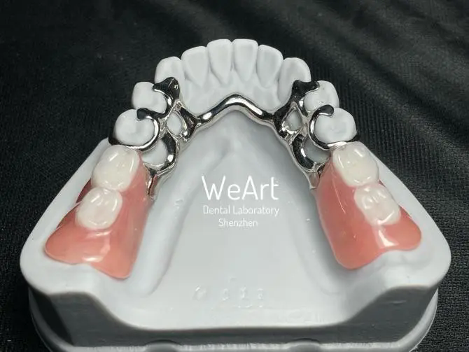 What Makes Removable Restoration a Reliable Solution for Dental Patients?