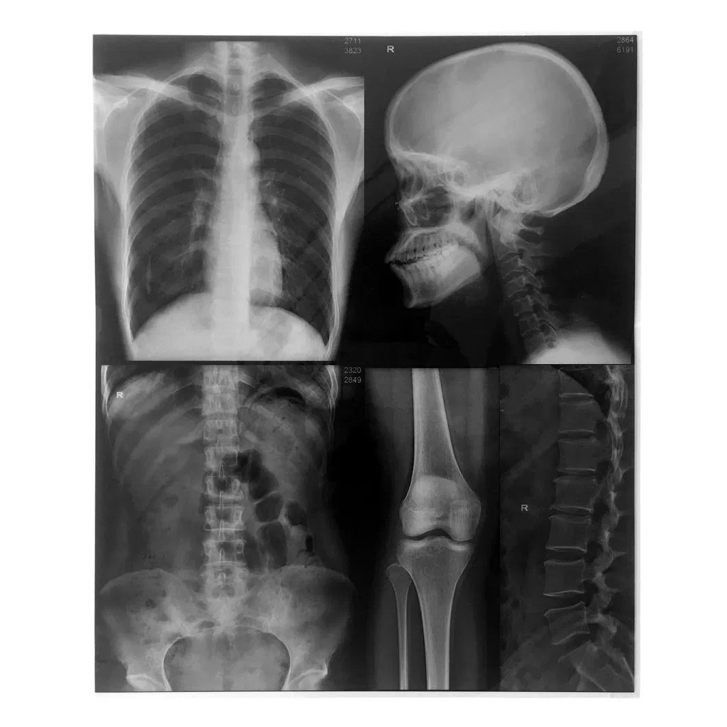 28cm*36cm Medical Dry Film for Epson 1800 and Epson 1300 Inkjet Printer