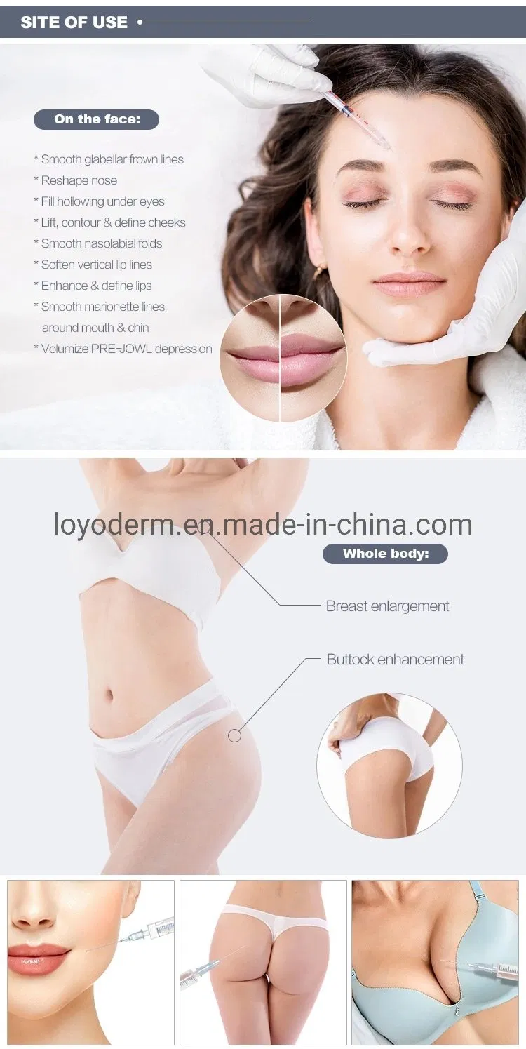 Anti Adhesive Gel Hyaluronic Acid Gel for Abdominal and Pelvic Surgery
