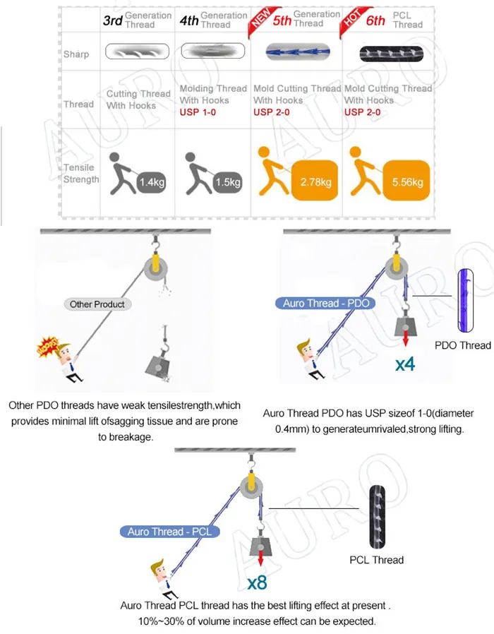 Auro Thread Press Surgical Suture Lifting Cog3d 4D 6D Pdo Thread