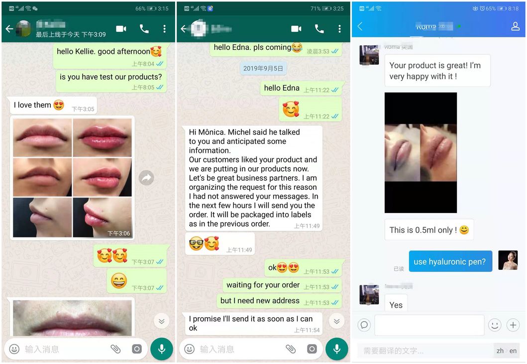 Bouliga Beed Filler Cross Linked Ha 5ml Dermal Filler for Add Volume and Enhance Lips