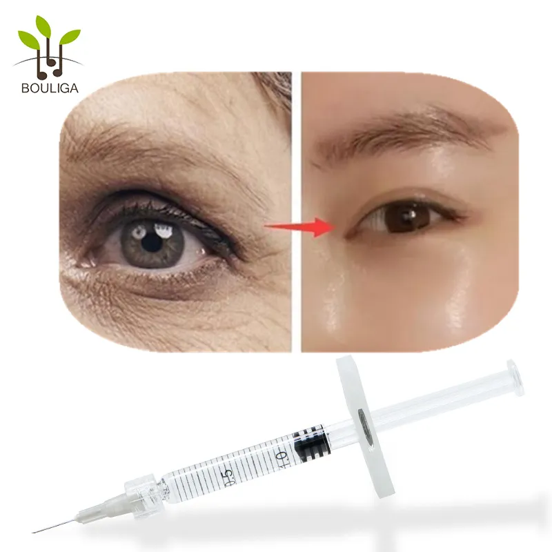 Bouliga Hot Sale 1ml Ha Dermal Filler Lip Injections Hialuronic Acid Filler Injection for Lip