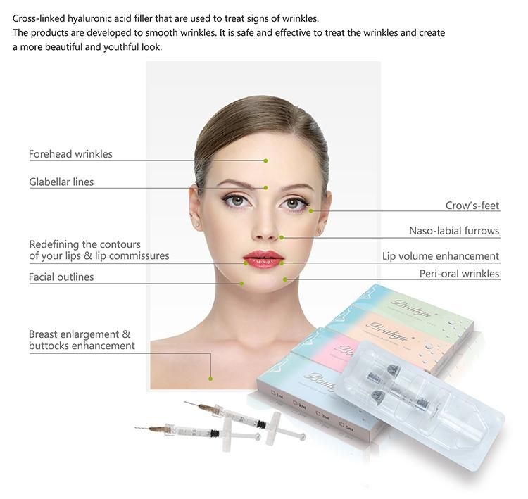 Bouliga Hot Sale 1ml Ha Dermal Filler Lip Injections Hialuronic Acid Filler Injection for Lip