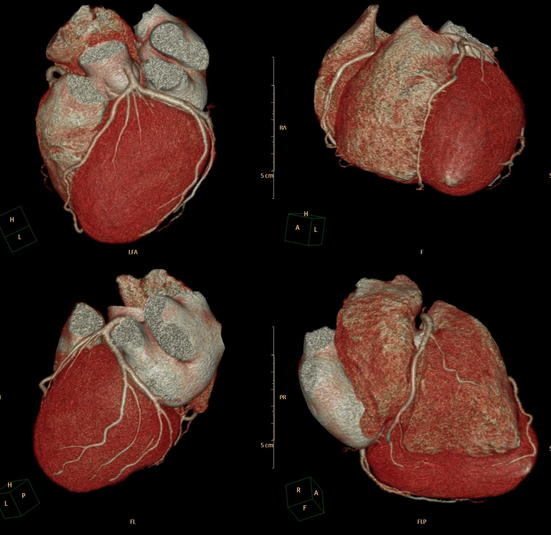 Cheap Inkjet Blue Medical X Ray Films