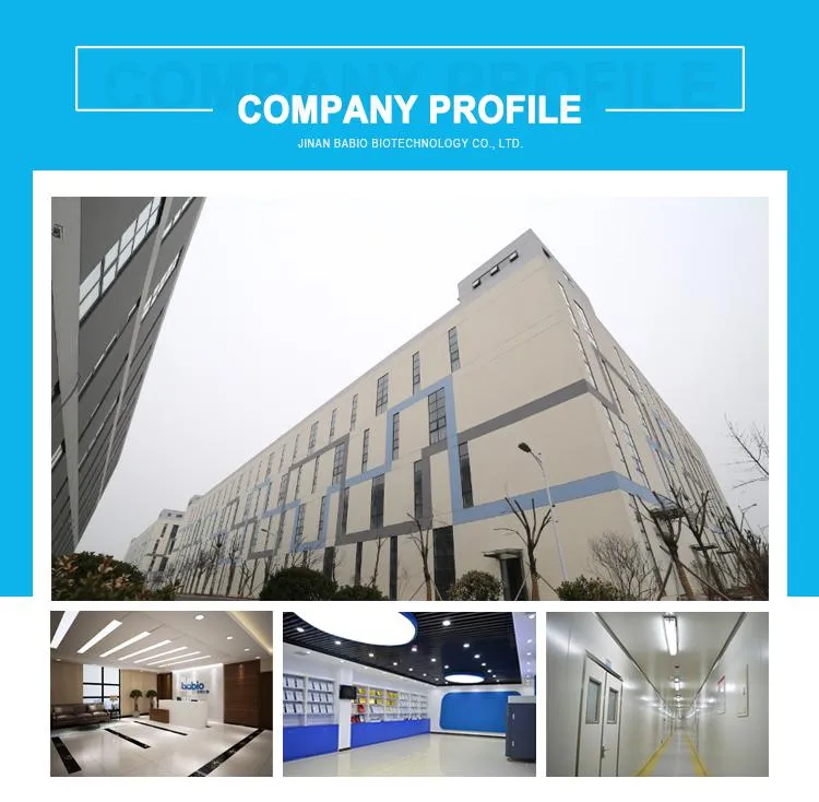 Customize Packing Mycoplasma Manufacturer Mass Production Sales Pneumoniae Igm Test Kit