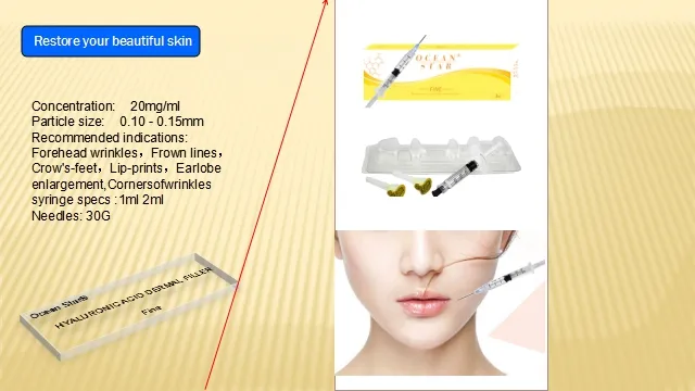 Dermal Filler Hyaluronic Acid Filler Korea Dermal Filer for Facial Injection