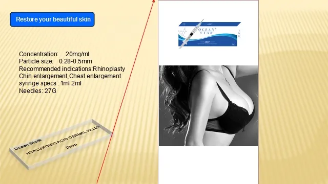 Dermal Filler Hyaluronic Acid Filler Korea Dermal Filer for Facial Injection