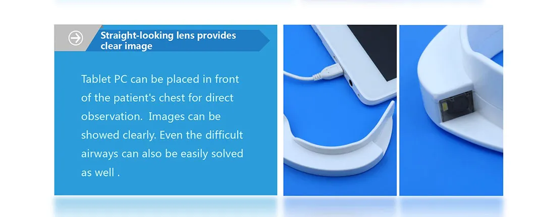 Difficult Airway Severely Ill Ventilator Airway Intubation Disposable Visual Laryngoscope