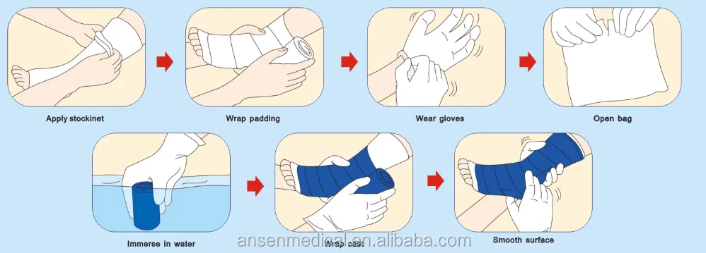 Factory Price Medical Plaster of Paris Bandage Synthetic Casting Tape