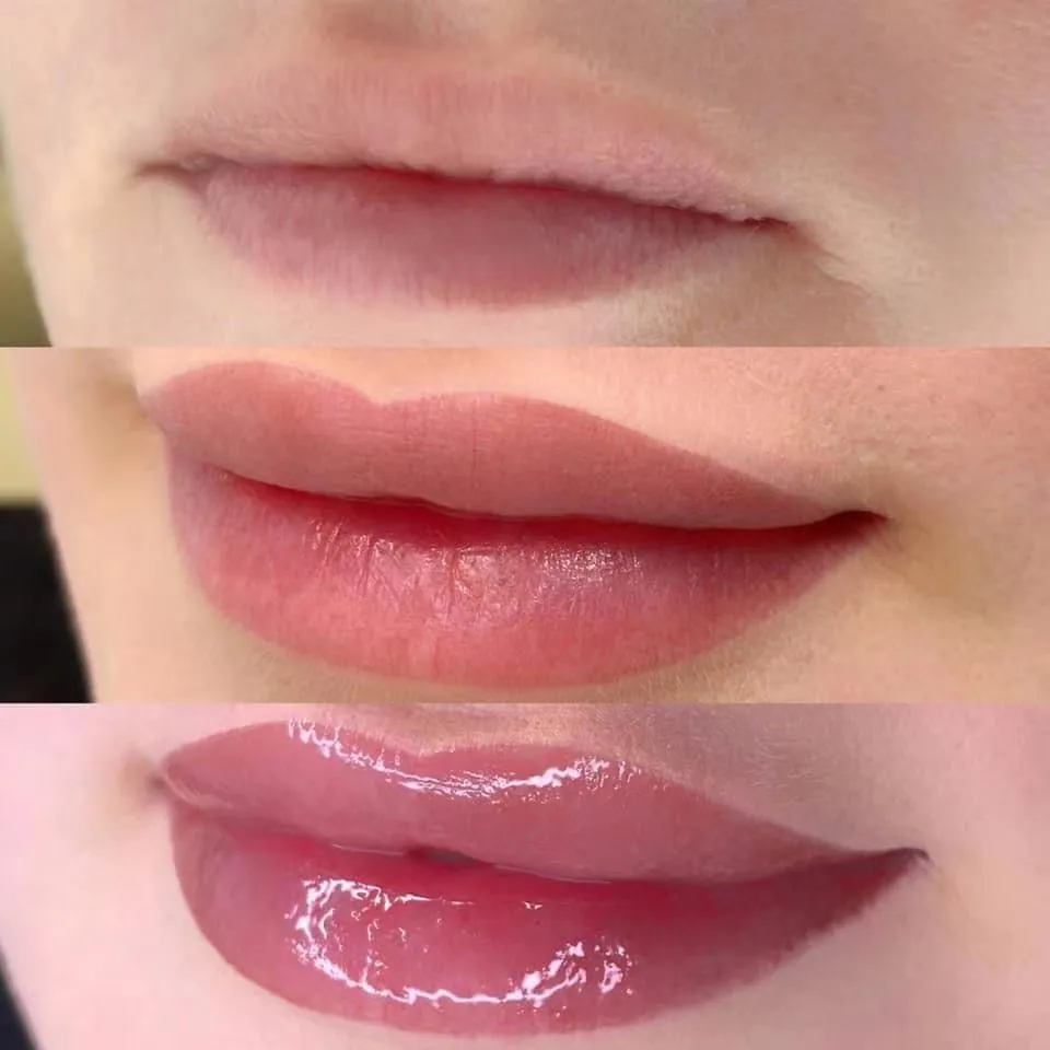 Fine/Derm/Deep 1ml 2ml Cross Linked Ha Injectable Hyaluronic Acid Dermal Filler for Nose