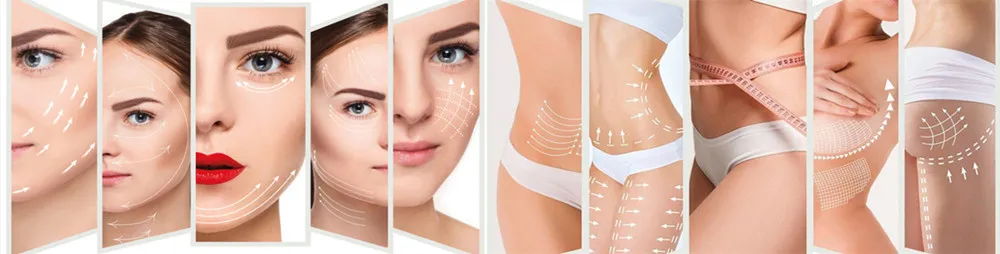 Hot Selling Safe Korea Face V Lifting Pdo Thread Mono Cog