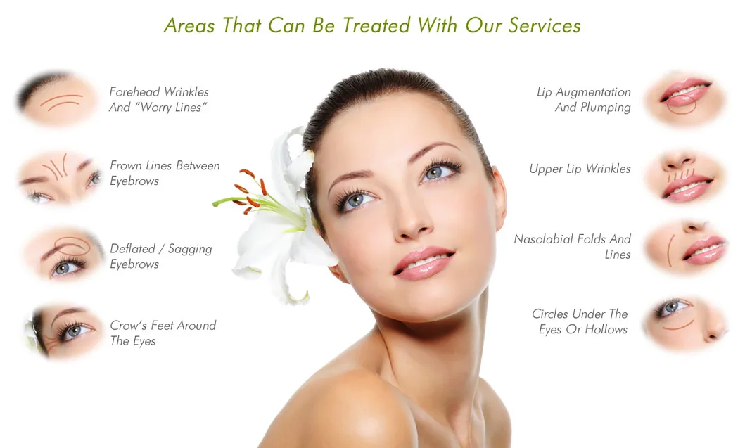 Hyaluronic Acid Dermal Fillers for Chin Area Sagging Jowls Injection Sodium Hyaluronate Gel