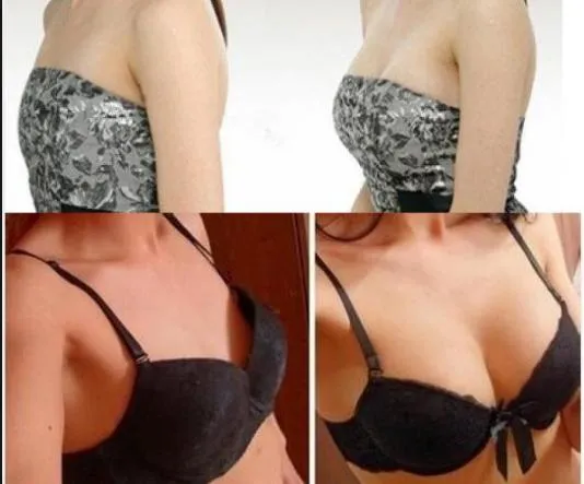 Hyaluronic Acid Dermal Fillers for Chin Area Sagging Jowls Injection Sodium Hyaluronate Gel