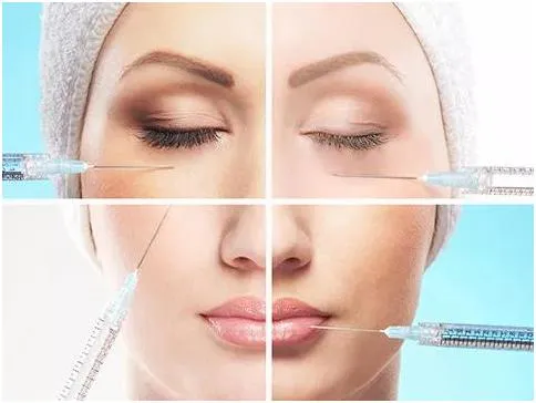 Hyaluronic Acid Dermal Fillers for Chin Area Sagging Jowls Injection Sodium Hyaluronate Gel