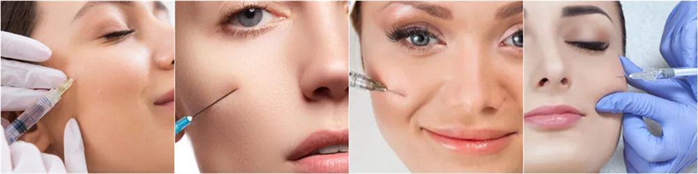 Hyaluronic Acid Facial Injectable 2ml Deeper Dermal Filler for Face Sharpe