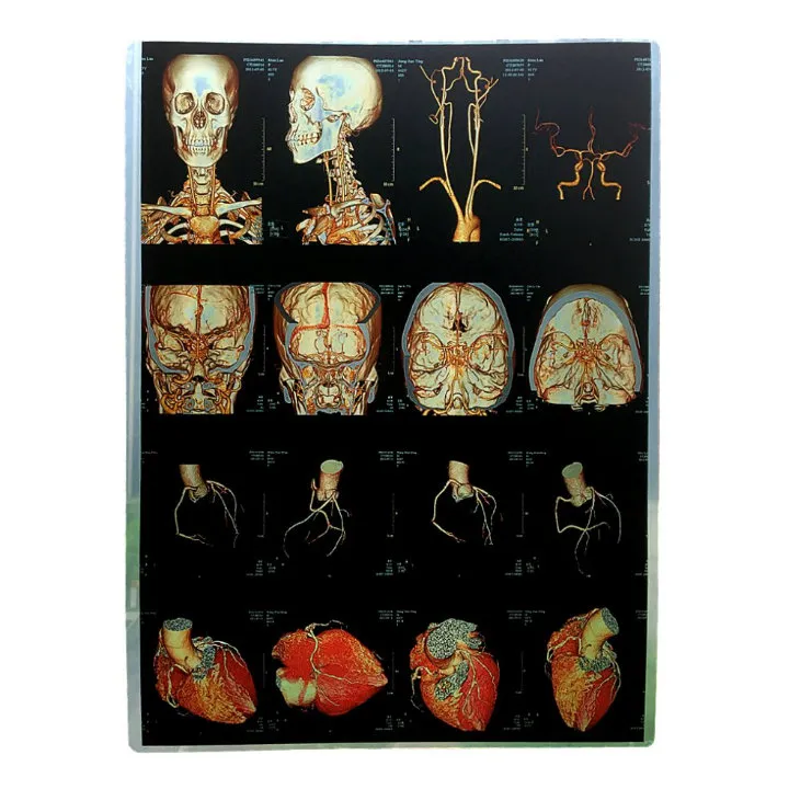 Inkjet Medical X Ray Blue/White Film