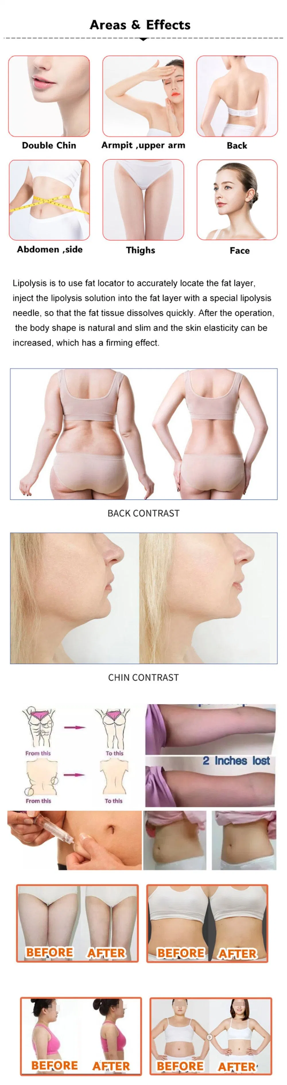 Korea Lipolab Lipo Lab Ppc Lipolytic Solution Fat Dissolve Body Slimming