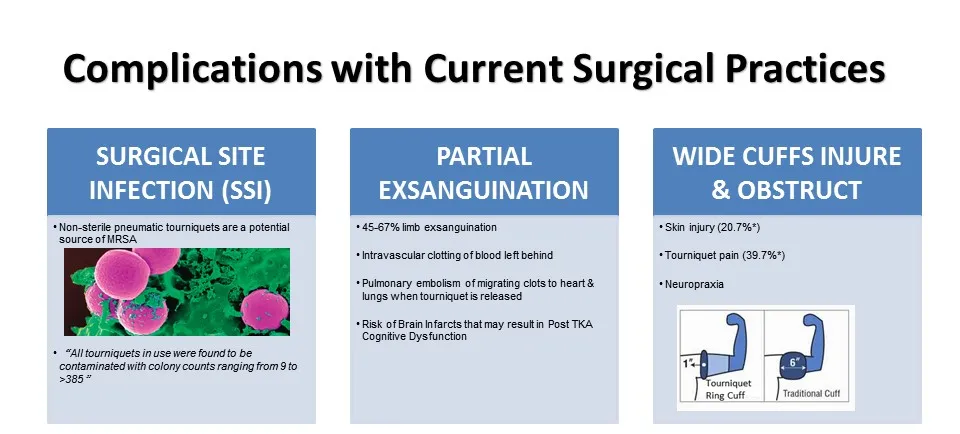 Latex-Free Silicone Elastic Ring Disposable Sterile Exsanguinating Tourniquet Cuff for Bloodless Limb Surgery Orthopedic Non-Pneumatic Equipment