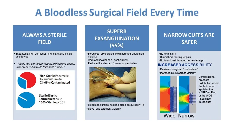 Latex-Free Silicone Elastic Ring Disposable Sterile Exsanguinating Tourniquet Cuff for Bloodless Limb Surgery Orthopedic Non-Pneumatic Equipment