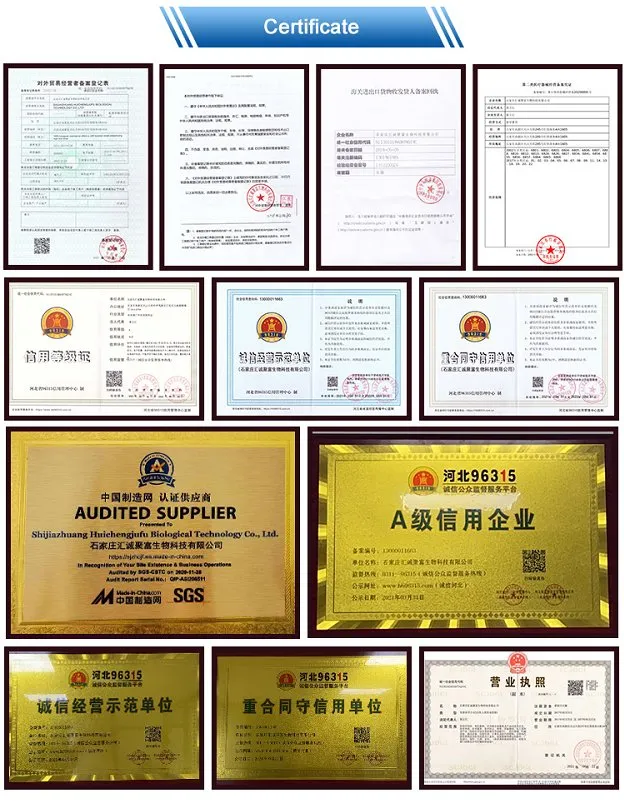 Level 2 Manufacturer SMS/SMMS Hospita Medica Isolation Disposable Protective Clothing