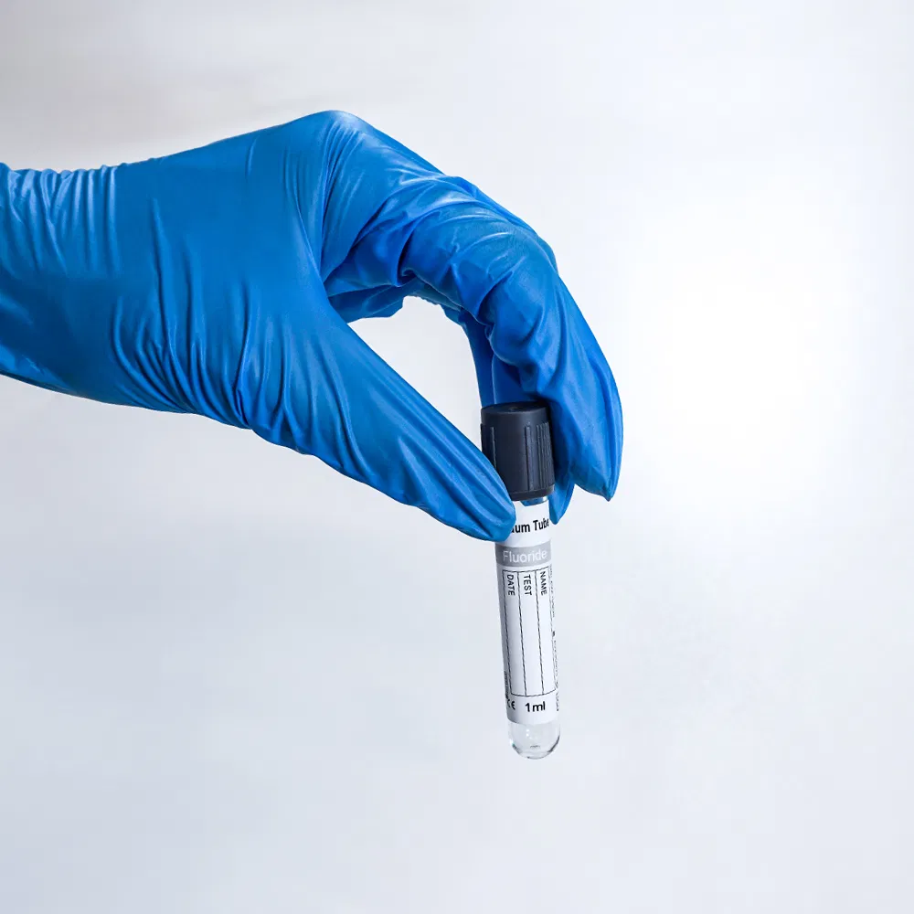 Medical-Grade Prp Vacutainer with Customized Size for Single Use Only