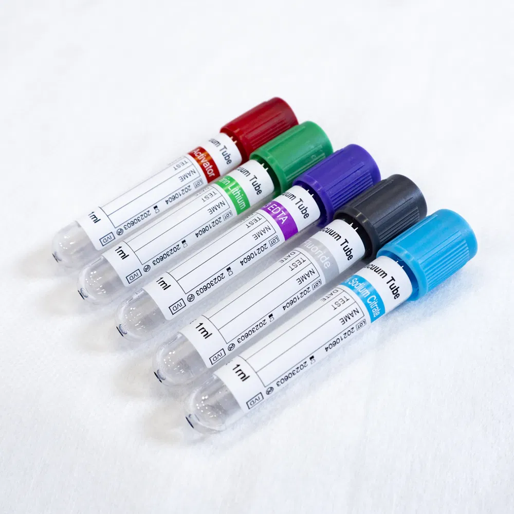 Medical-Grade Prp Vacutainer with Customized Size for Single Use Only