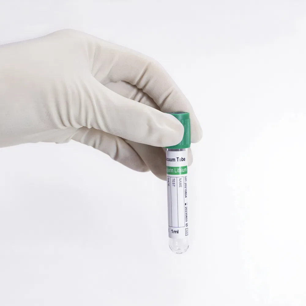 Medical-Grade Prp Vacutainer with Customized Size for Single Use Only