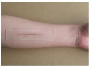 Medical Silicone-Get Sheet for Scar Hyperplasia and Skin Transplantation Surgery