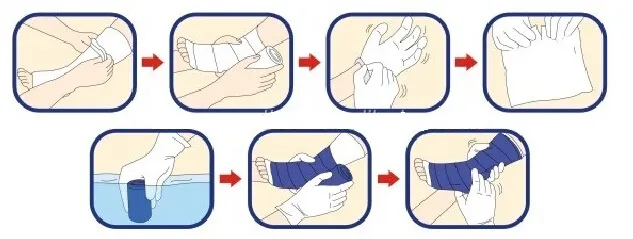 Medical Supplies Fibreglass Casting Tape FDA Approved Fabric Fiber Glass Orthopedic Casting Tape Optima Casts for Fractures