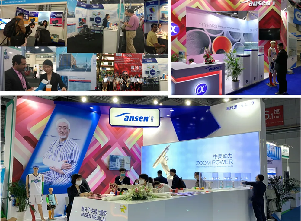 Medical Supplies Fibreglass Casting Tape FDA Approved Fabric Fiber Glass Orthopedic Casting Tape Optima Casts for Fractures