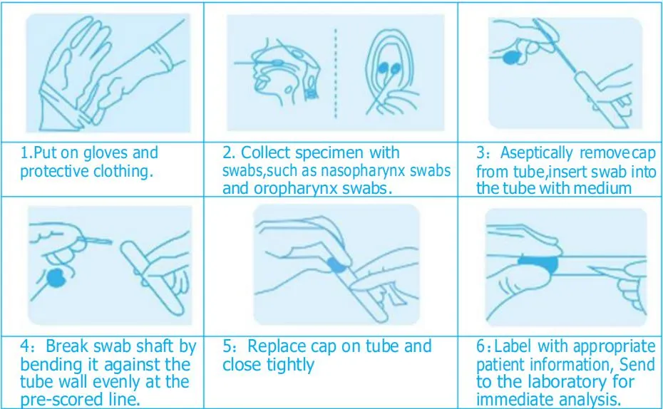 Oropharynx Swab Medical 3cm Breakpoint and 8cm Breakpoint Disposable Virus Sampling Tube Kit