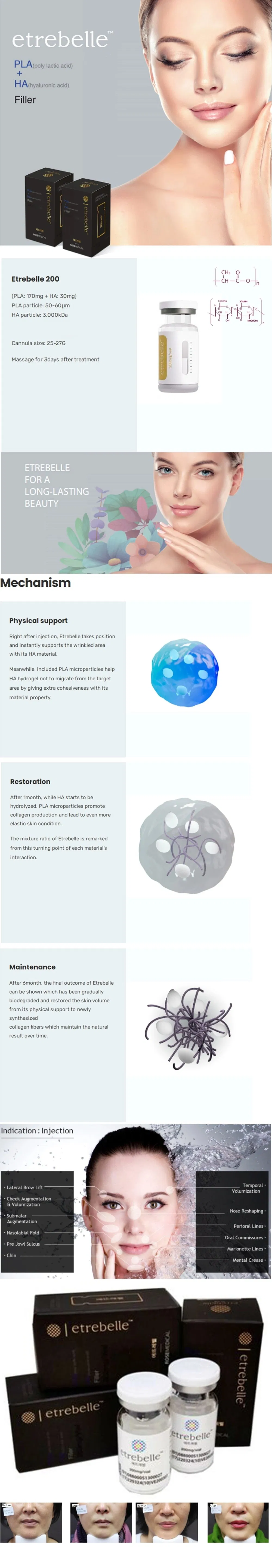 Promotion Collagen Production Anti-Aging Etrebelle PLA Hyaluronic Acid Injection Facial Augmentation