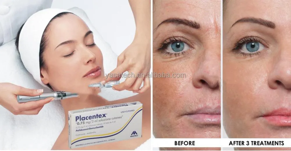 Skin Booster Mesotherapy Placentex Skin Rejuvenation