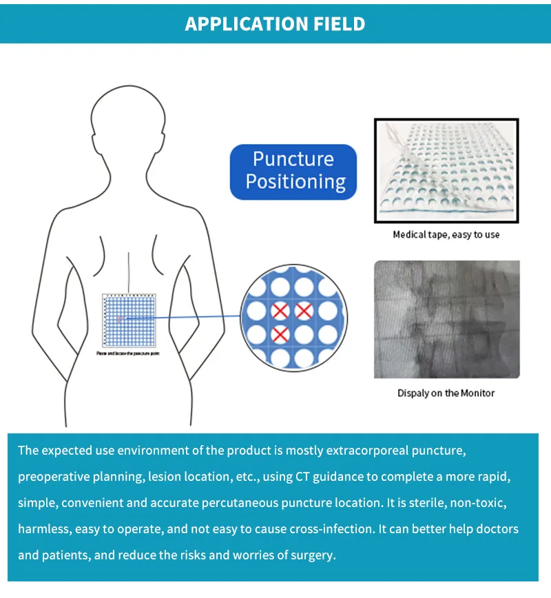 Spinal Procedure Use Detectable Positioning Tape