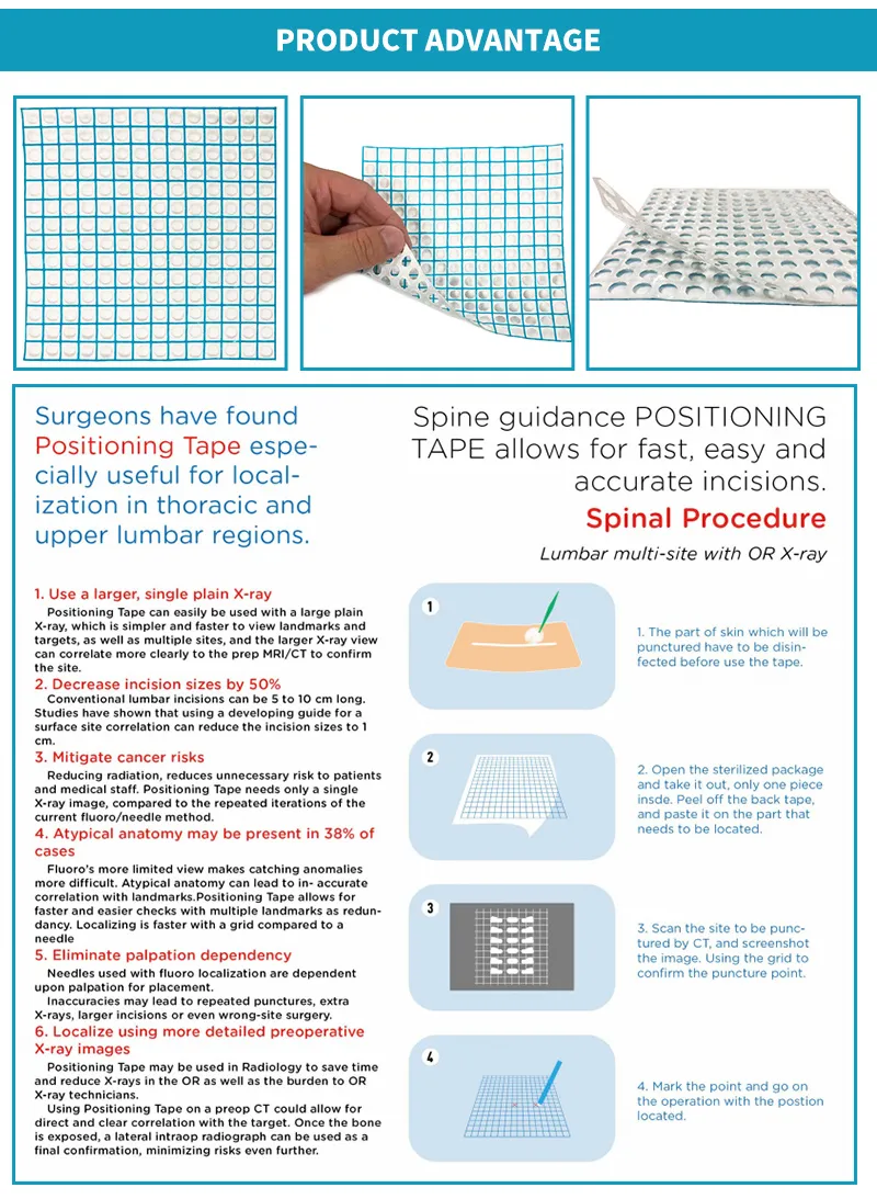 Spinal Procedure Use Detectable Positioning Tape