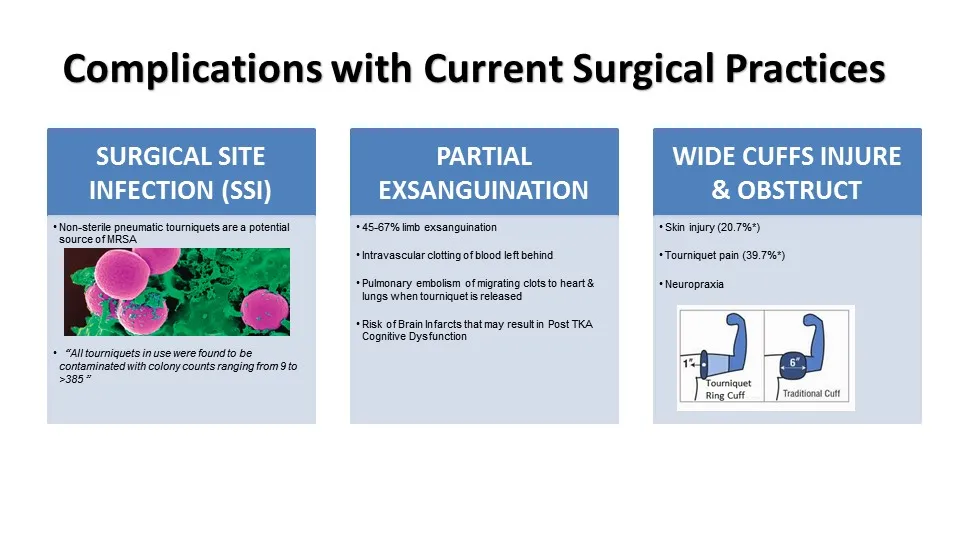 Sterilized Disposable Exsanguination Occlusion Tourniquet Cuff with Silicone Ring Medical/Surgical Product to Stop Bloodloss in Emergency Aid and Limb Surgeries