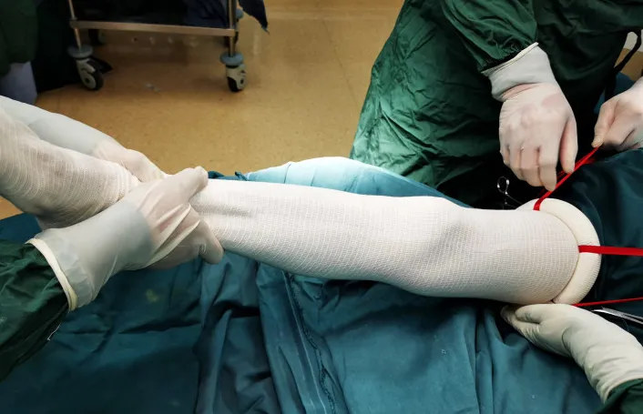 Sterilized Disposable Exsanguination Occlusion Tourniquet Cuff with Silicone Ring Medical/Surgical Product to Stop Bloodloss in Emergency Aid and Limb Surgeries