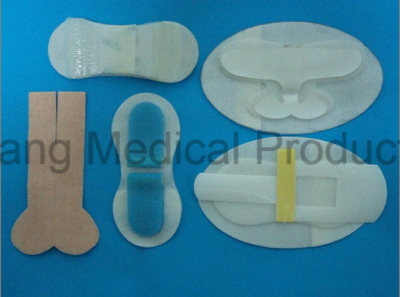 Surgical Disposable Medical IV Cannula Remaining Needle Fixation Device Stabilization Dressing
