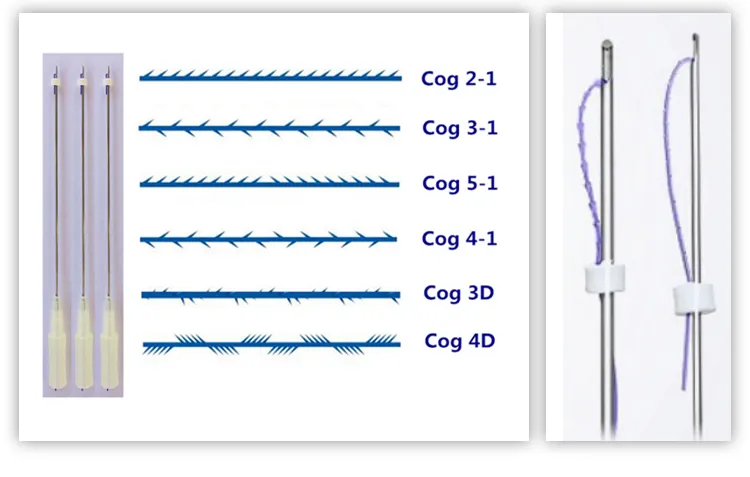 Thread V-Lifting Cog 3D 4D 6D Blunt Micro Cannula Pdo Thread