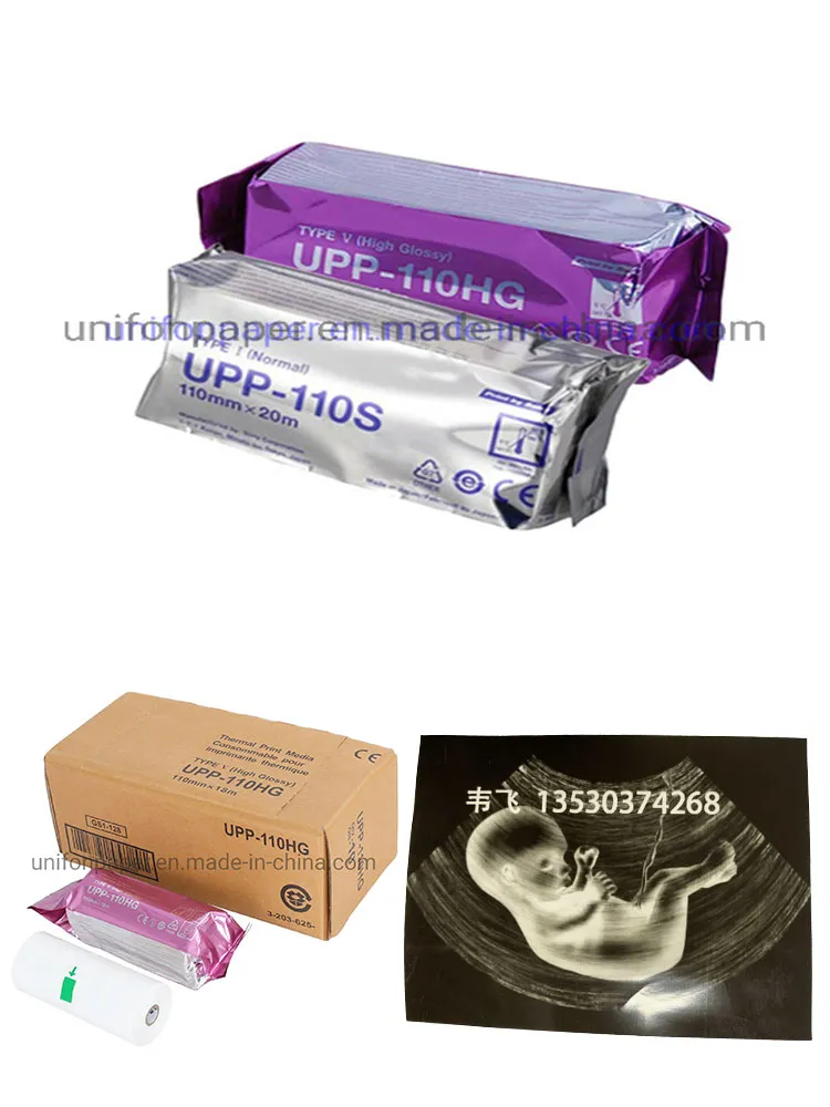 Upp110hg Ultrasound Thermal Paper Upp-110hg 110mm X 18m for Sony up-890 up-895 up-897 Thermal Printer
