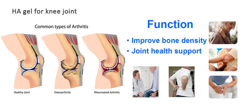 Wholesale Intra Articular Hyaluronic Acid Injections Knee Dermal Filler Price Pain Knee Joint Injection