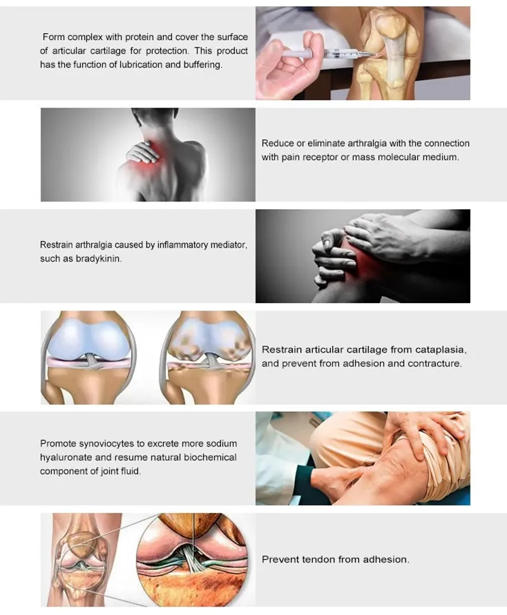 Wholesale Intra Articular Hyaluronic Acid Injections Knee Dermal Filler Price Pain Knee Joint Injection