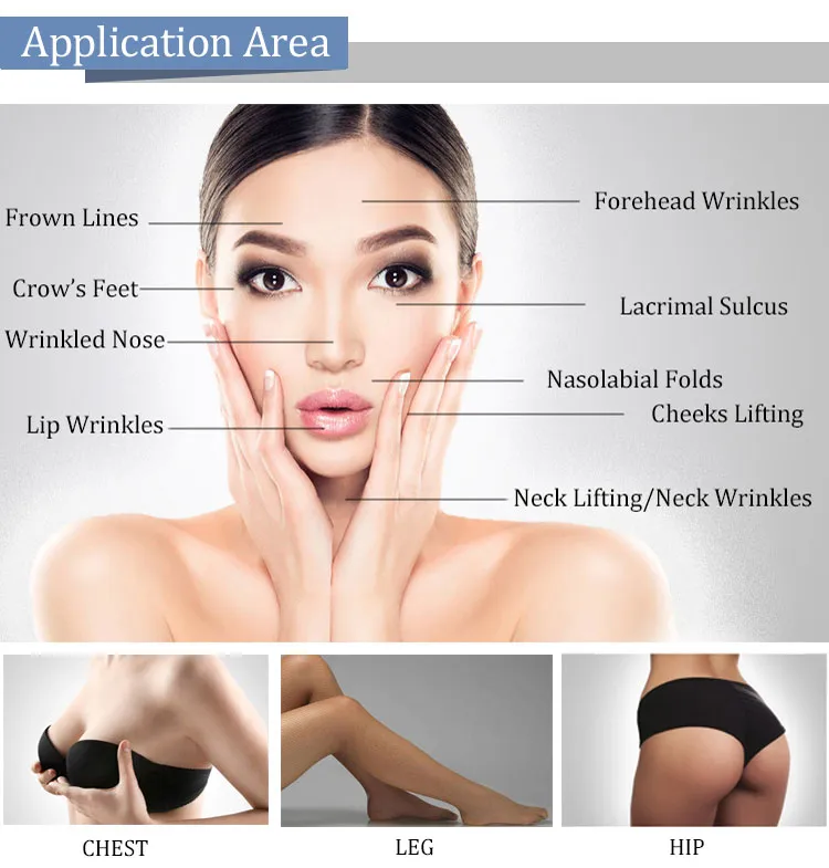 Yarn Wholesale Beauty V Line Lifting Face Wrinkle Removal Pdo with Needle Thread